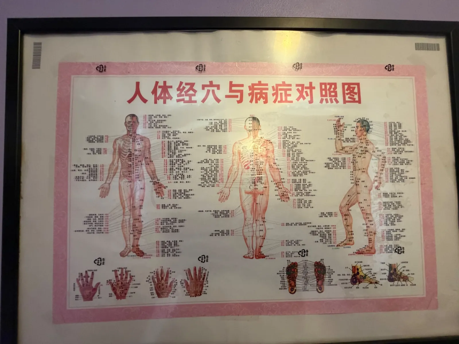 Planche murale chinoise « 人体经穴与病症对照图 » affichée dans le centre, points d'acupression et zones réflexes
